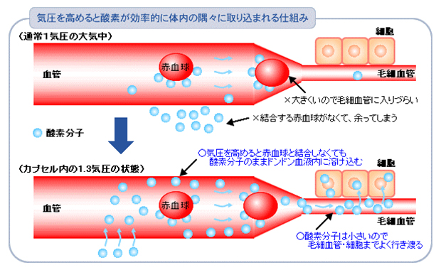 酸素カプセルの効果